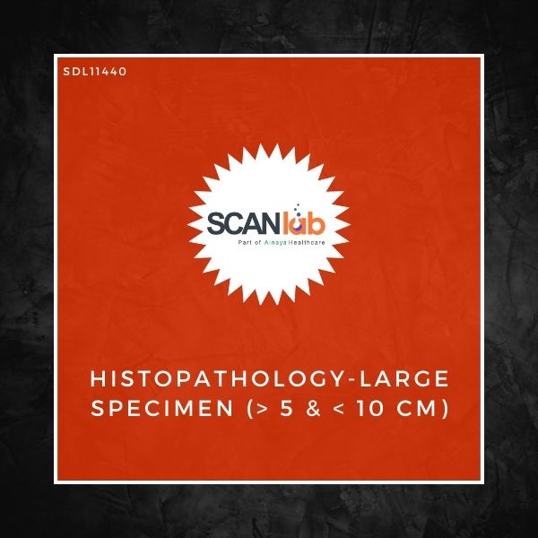 HISTOPATHOLOGY-LARGE SPECIMEN (> 5 & < 10 CM) (SDL11440)