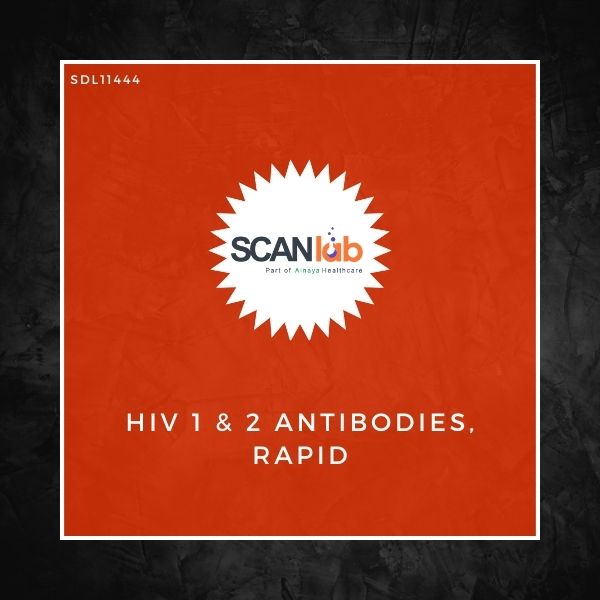 HIV 1 & 2 ANTIBODIES, RAPID (SDL11444)