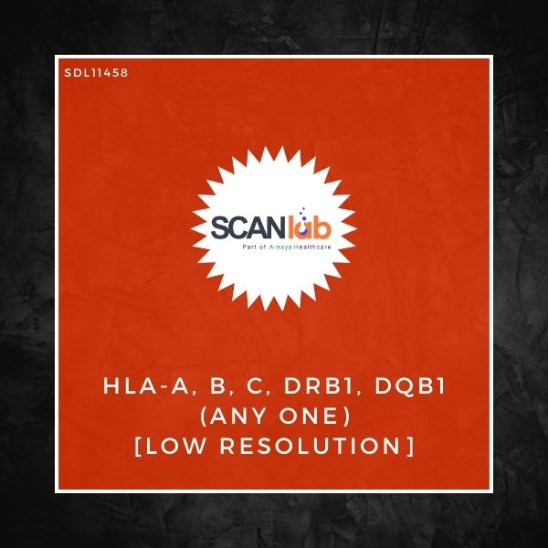 HLA-A, B, C, DRB1, DQB1 (ANY ONE) [LOW RESOLUTION] (SDL11458)