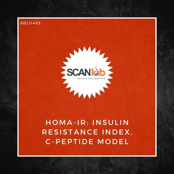 HOMA-IR: INSULIN RESISTANCE INDEX, C-PEPTIDE MODEL (SDL11483)
