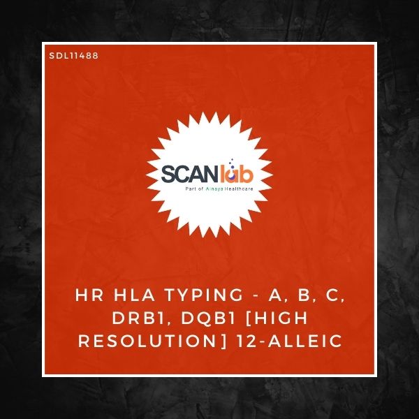 HR HLA TYPING-A, B, C, DRB1, DQB1 [HIGH RESOLUTION] 12-ALLEIC (SDL11488)