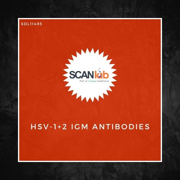 HSV-1+2 IGM ANTIBODIES (SDL11495)