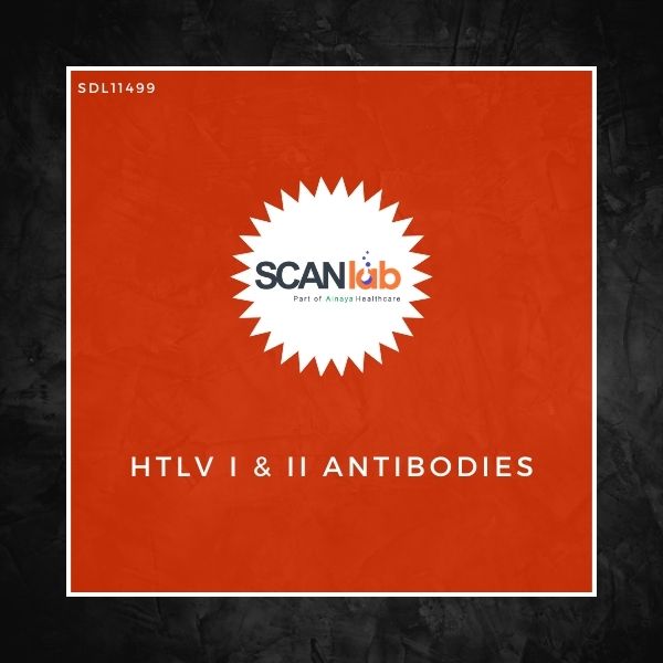 HTLV I & II ANTIBODIES (SDL11499)