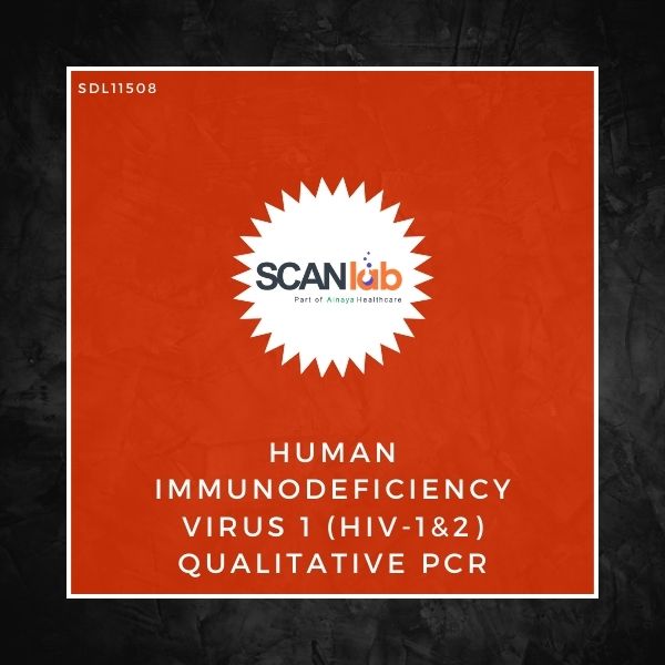 HUMAN IMMUNODEFICIENCY VIRUS 1 (HIV-1&2) QUALITATIVE PCR (SDL11508)