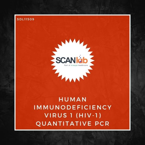 HUMAN IMMUNODEFICIENCY VIRUS 1 (HIV-1) QUANTITATIVE PCR (SDL11509)