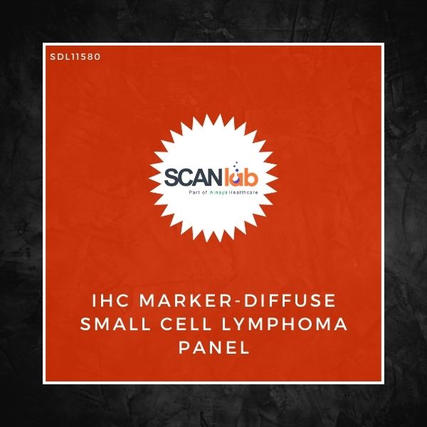 IHC MARKER-DIFFUSE SMALL CELL LYMPHOMA PANEL (SDL11580)
