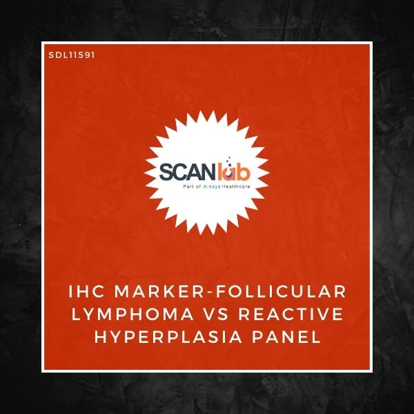 IHC MARKER-FOLLICULAR LYMPHOMA VS REACTIVE HYPERPLASIA PANEL (SDL11591)