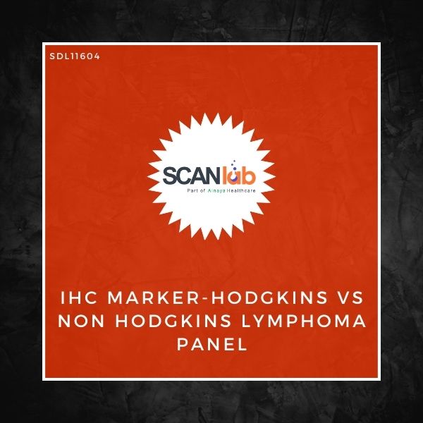 IHC MARKER-HODGKINS VS NON HODGKINS LYMPHOMA PANEL (SDL11604)