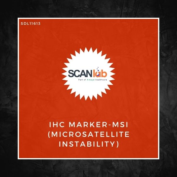 IHC MARKER-MSI (MICROSATELLITE INSTABILITY) (SDL11613)