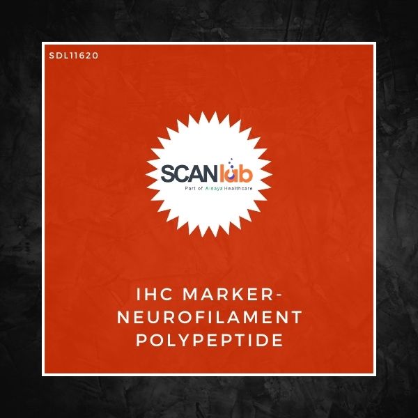 IHC MARKER-NEUROFILAMENT POLYPEPTIDE (SDL11620)