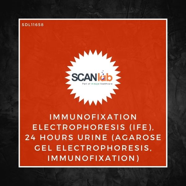 IMMUNOFIXATION ELECTROPHORESIS (IFE), 24 HOURS URINE (AGAROSE GEL ELECTROPHORESIS, IMMUNOFIXATION) (SDL11658)