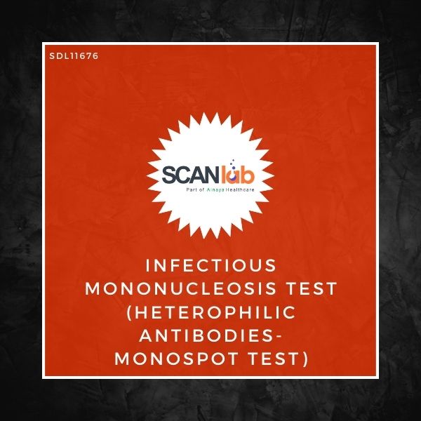 INFECTIOUS MONONUCLEOSIS TEST (HETEROPHILIC ANTIBODIES-MONOSPOT TEST) (SDL11676)