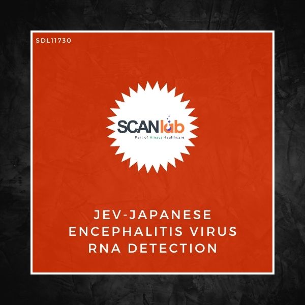 JEV-JAPANESE ENCEPHALITIS VIRUS RNA DETECTION (SDL11730)