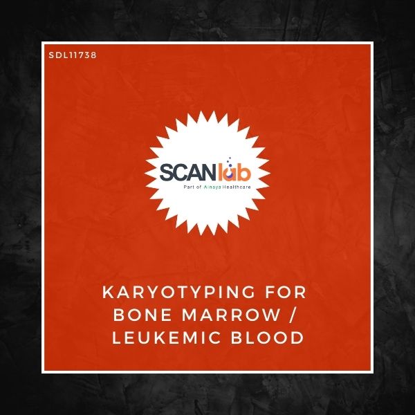 KARYOTYPING FOR BONE MARROW/LEUKEMIC BLOOD (SDL11738)