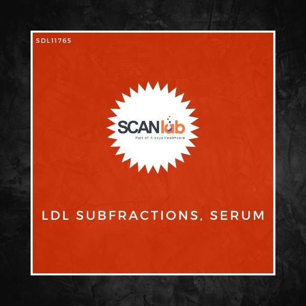 LDL SUBFRACTIONS, SERUM (SDL11765)