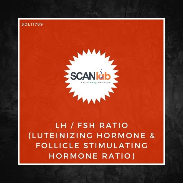 LH/FSH RATIO (LUTEINIZING HORMONE & FOLLICLE STIMULATING HORMONE RATIO) (SDL11789)