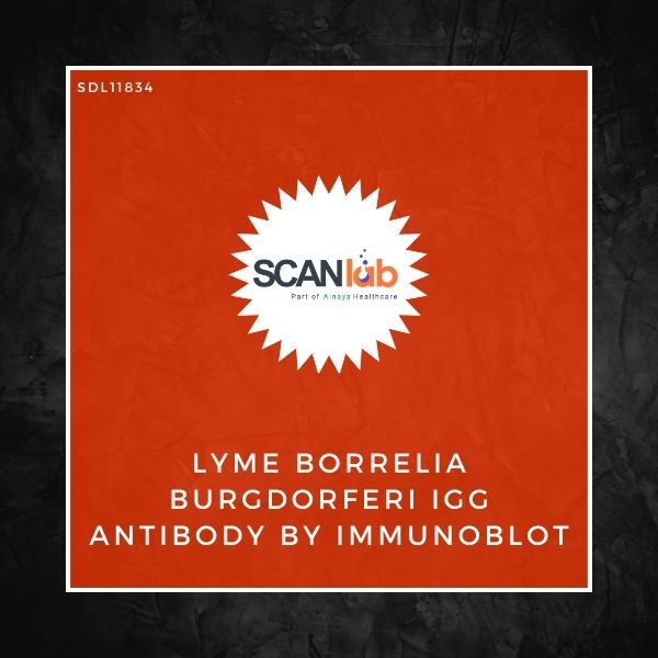LYME BORRELIA BURGDORFERI IGG ANTIBODY BY IMMUNOBLOT (SDL11834)