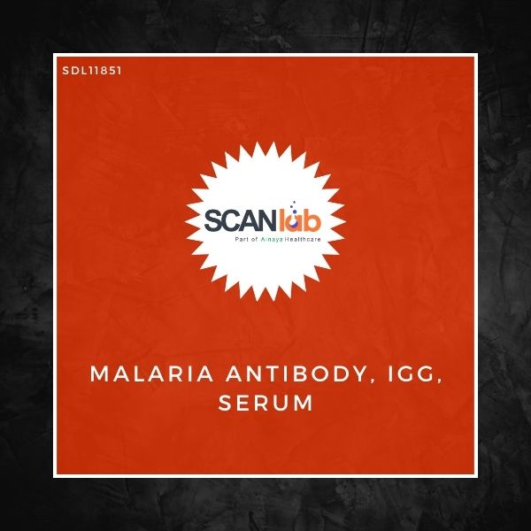 MALARIA ANTIBODY, IGG, SERUM (SDL11851)