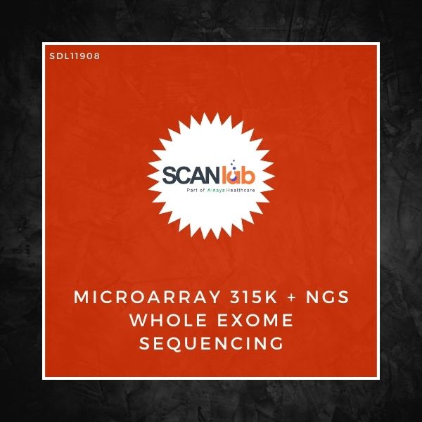 MICROARRAY 315K+NGS WHOLE EXOME SEQUENCING (SDL11908)