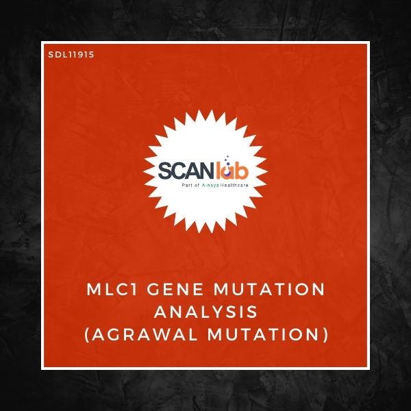 MLC1 GENE MUTATION ANALYSIS (AGRAWAL MUTATION) (SDL11915)