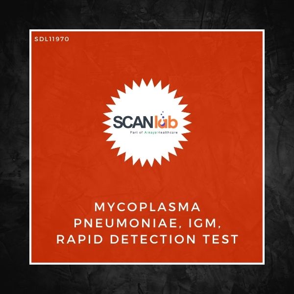 MYCOPLASMA PNEUMONIAE, IGM, RAPID DETECTION TEST (SDL11970)