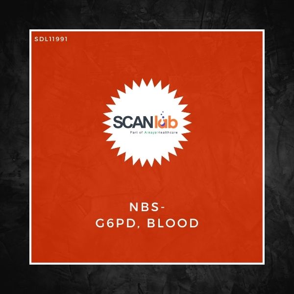 NBS-G6PD, BLOOD (SDL11991)