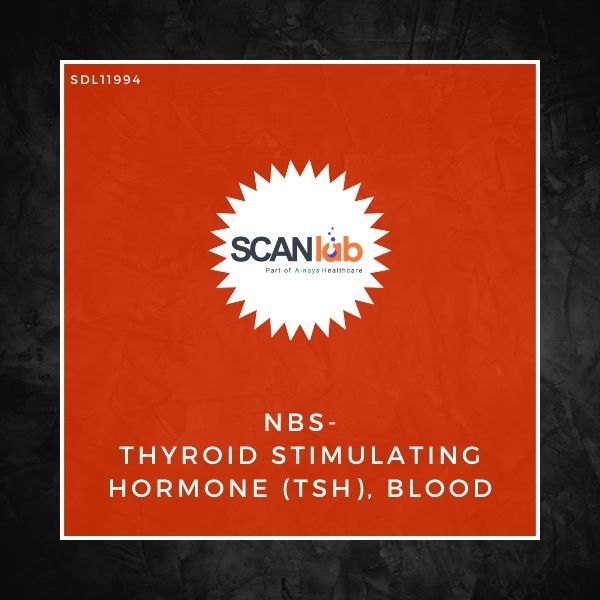 NBS-THYROID STIMULATING HORMONE (TSH), BLOOD (SDL11994)