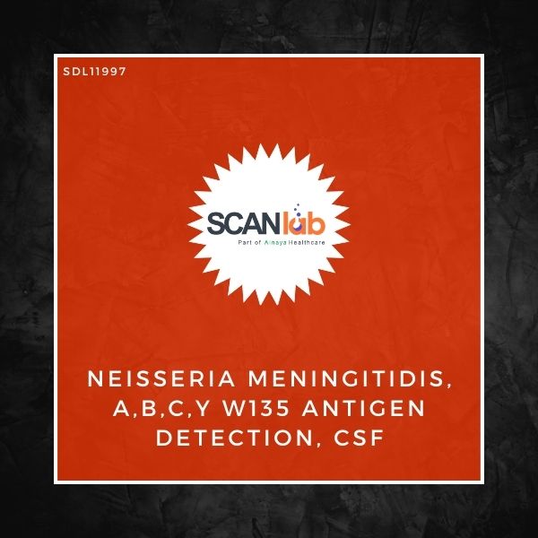 NEISSERIA MENINGITIDIS, A,B,C,Y W135 ANTIGEN DETECTION, CSF (SDL11997)