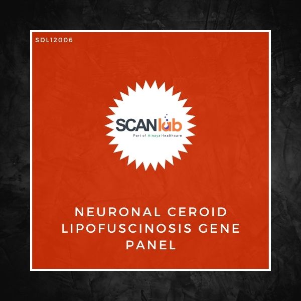 NEURONAL CEROID LIPOFUSCINOSIS GENE PANEL (SDL12006)