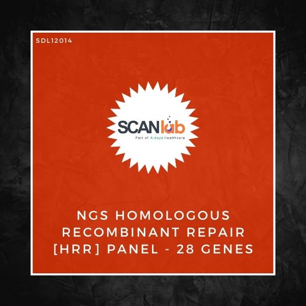 NGS HOMOLOGOUS RECOMBINANT REPAIR [HRR] PANEL-28 GENES (SDL12014)