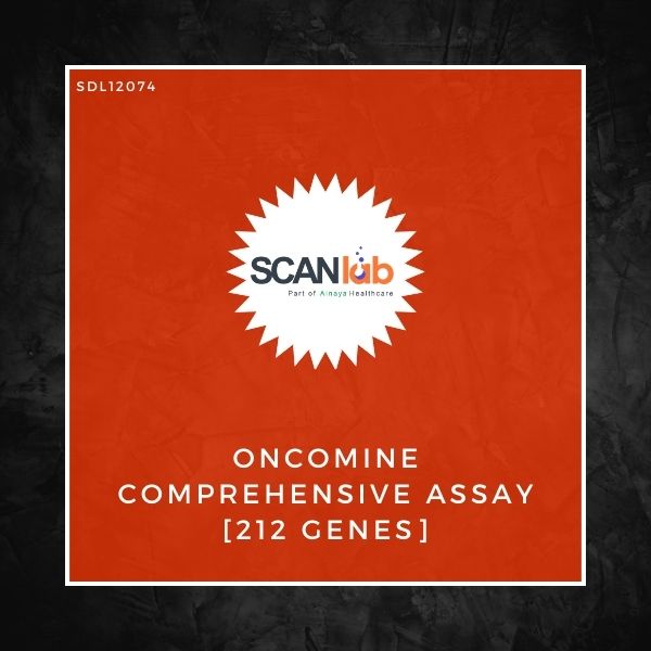 ONCOMINE COMPREHENSIVE ASSAY [212 GENES] (SDL12074)