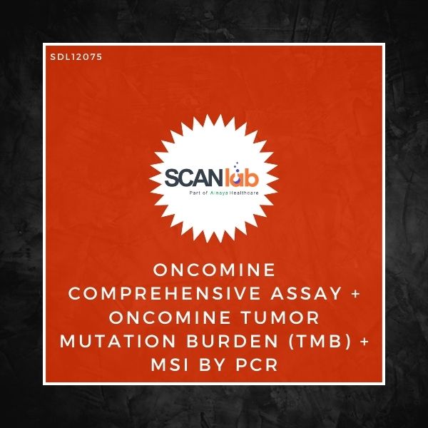 ONCOMINE COMPREHENSIVE ASSAY+ONCOMINE TUMOR MUTATION BURDEN (TMB)+MSI BY PCR (SDL12075)