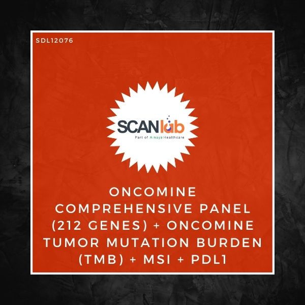 ONCOMINE COMPREHENSIVE PANEL (212 GENES)+ONCOMINE TUMOR MUTATION BURDEN (TMB)+MSI+PDL1 (SDL12076)
