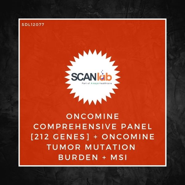 ONCOMINE COMPREHENSIVE PANEL [212 GENES]+ONCOMINE TUMOR MUTATION BURDEN+MSI (SDL12077)