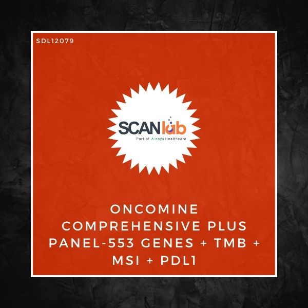 ONCOMINE COMPREHENSIVE PLUS PANEL-553 GENES+TMB+MSI+PDL1 (SDL12079)