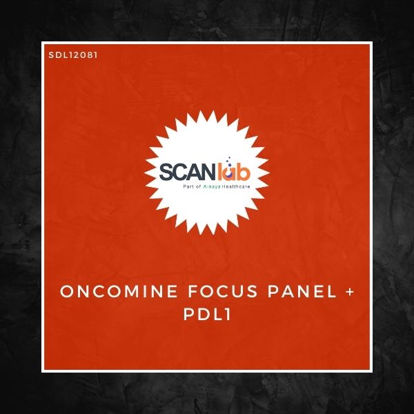 ONCOMINE FOCUS PANEL+PDL1 (SDL12081)