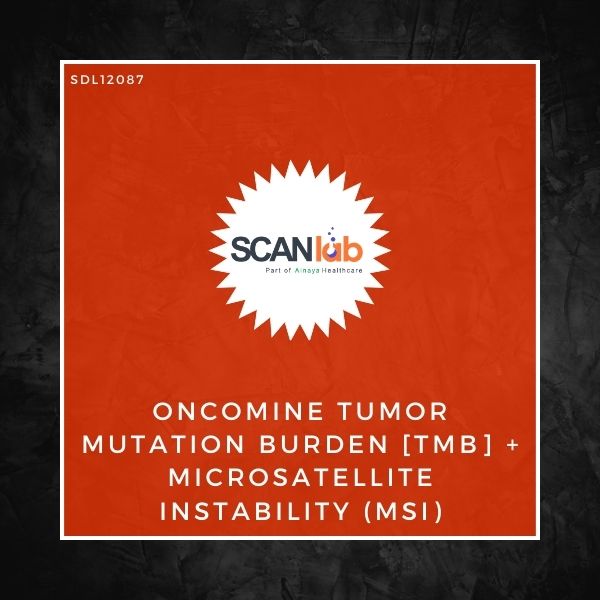 ONCOMINE TUMOR MUTATION BURDEN [TMB]+MICROSATELLITE INSTABILITY (MSI) (SDL12087)