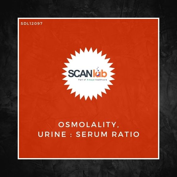 OSMOLALITY, URINE : SERUM RATIO (SDL12097)