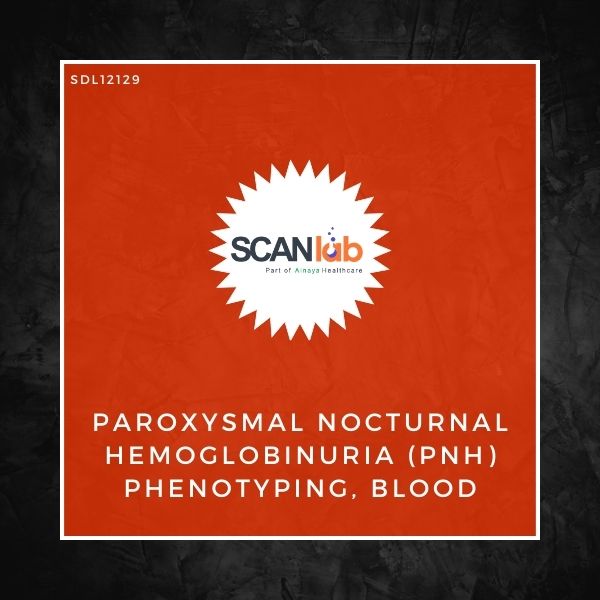 PAROXYSMAL NOCTURNAL HEMOGLOBINURIA (PNH) PHENOTYPING, BLOOD (SDL12129)