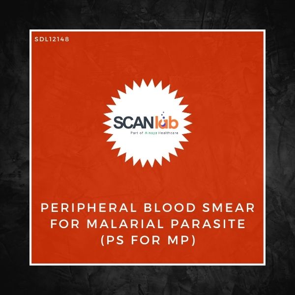 PERIPHERAL BLOOD SMEAR FOR MALARIAL PARASITE (PS FOR MP) (SDL12148)