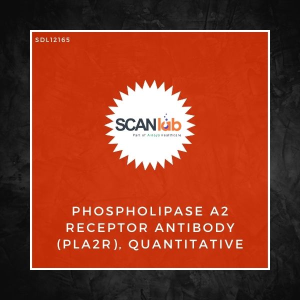 PHOSPHOLIPASE A2 RECEPTOR ANTIBODY (PLA2R), QUANTITATIVE (SDL12165)