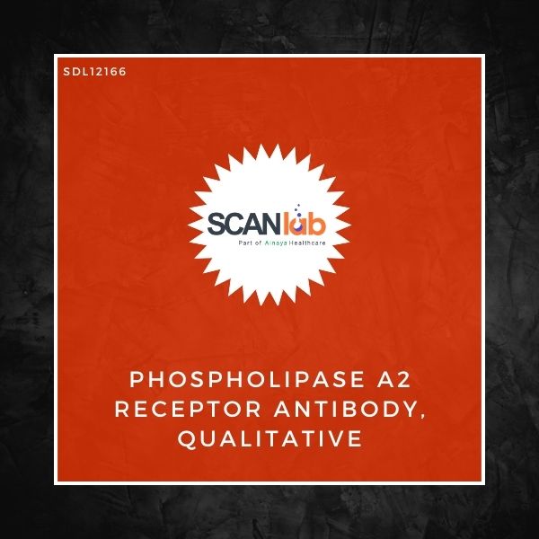 PHOSPHOLIPASE A2 RECEPTOR ANTIBODY QUALITATIVE (SDL12166)