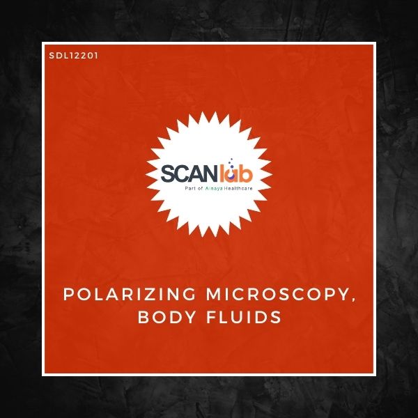 POLARIZING MICROSCOPY, BODY FLUIDS (SDL12201)