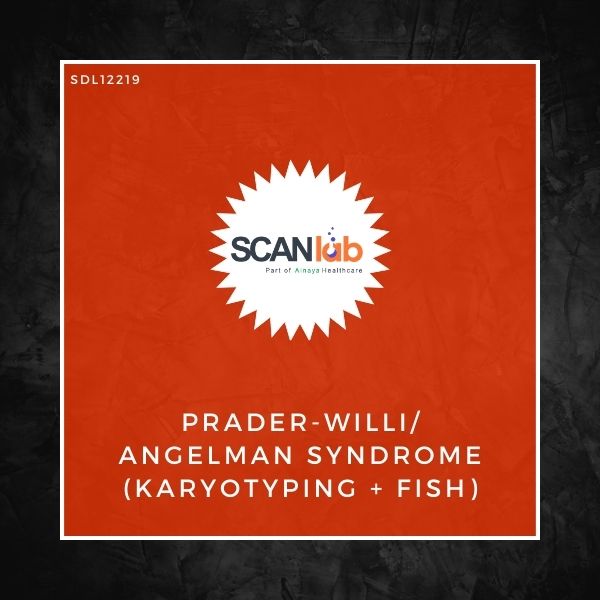 PRADER-WILLI/ANGELMAN SYNDROME (KARYOTYPING+FISH) (SDL12219)