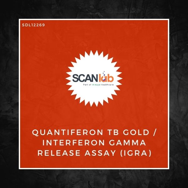 QUANTIFERON TB GOLD/INTERFERON GAMMA RELEASE ASSAY (IGRA) (SDL12269)