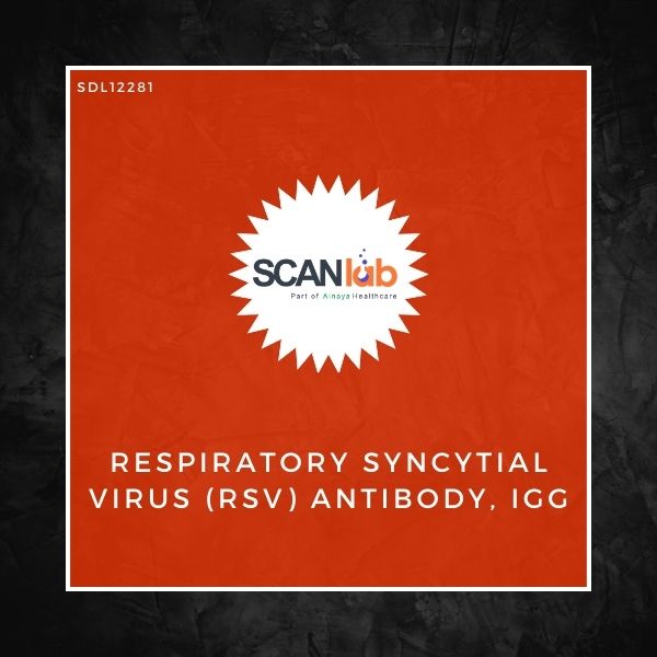 RESPIRATORY SYNCYTIAL VIRUS (RSV) ANTIBODY, IGG, SERUM (SDL12281)