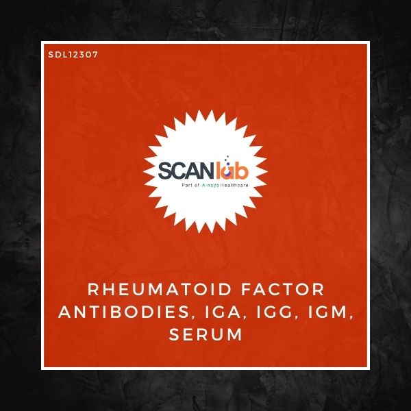 RHEUMATOID FACTOR ANTIBODIES, IGA, IGG, IGM, SERUM (SDL12307)