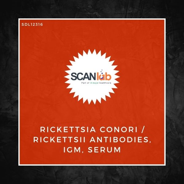 RICKETTSIA CONORI/RICKETTSII ANTIBODIES, IGM, SERUM (SDL12316)