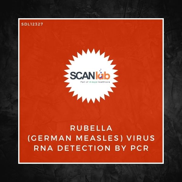 RUBELLA (GERMAN MEASLES) VIRUS RNA DETECTION BY PCR (SDL12327)