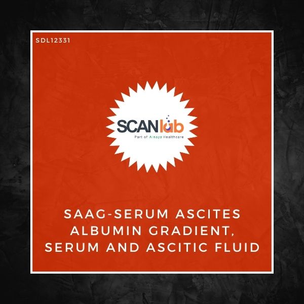 SAAG-SERUM ASCITES ALBUMIN GRADIENT, SERUM AND ASCITIC FLUID (SDL12331)